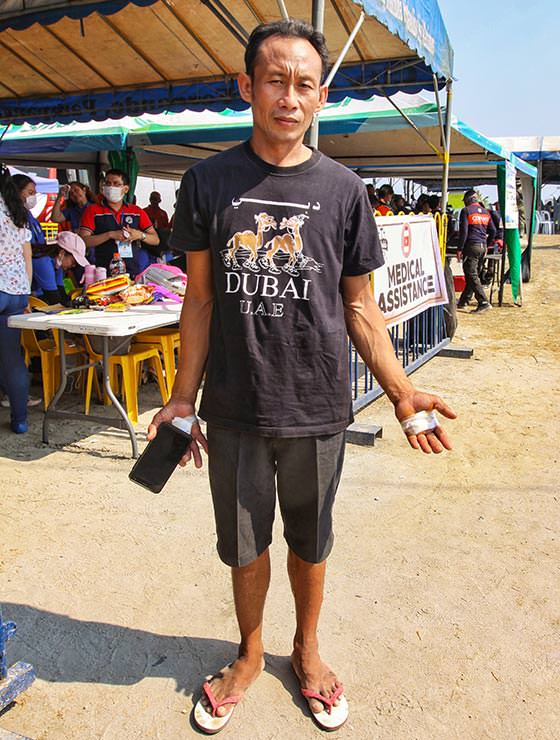 Angelito Mengilio, one of the crucified devotees at Maleldo 2019, showing his wrapped palm wounds in San Pedro Cutud, San Fernando, Pampanga, Philippines, photo by Ivan Kralj