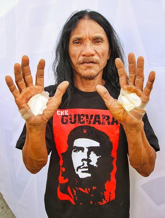 Ruben Enaje got crucified playing Jesus Christ for the 33rd time, here showing his wrapped palm wounds at Maleldo 2019, in San Pedro Cutud, San Fernando, Pampanga, Philippines, photo by Ivan Kralj