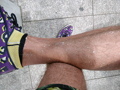 Salt crystalized on legs after bathing at Burgas Salt Pans in Bulgaria; photo by Ivan Kralj.