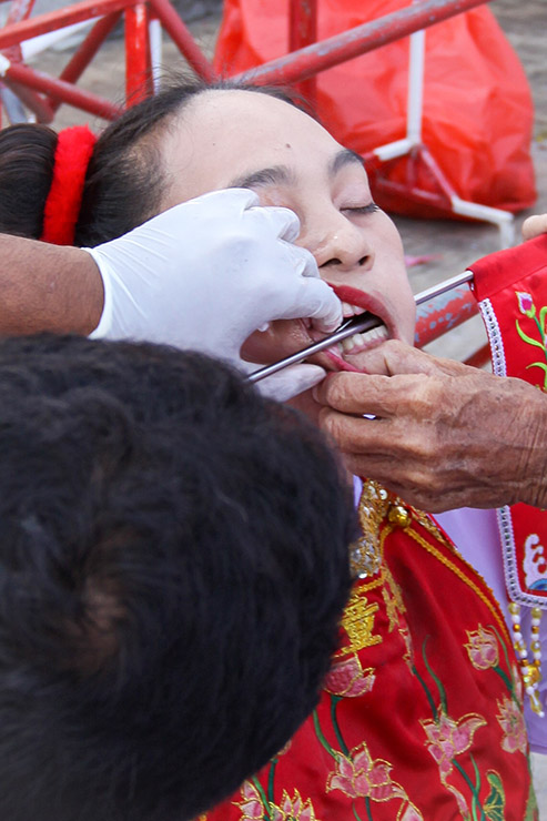 A metal rod piercing a cheek of a woman, a ma song spirit medium at Jor Soo Goong Naka Shrine, during Jay or Phuket Vegetarian Festival, also known as Thailand's self-mutilation festival; photo by Ivan Kralj.